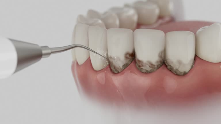 Reliable Dental Implants contractor in Remsen, IA by Smile Center Dentistry